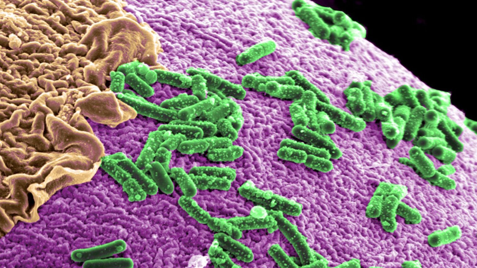 An image of a purple cell with green and yellow cells.